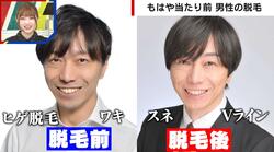 男性の脱毛は「BTSの出現」が影響 全身ツルツルの慶大教授が「脱毛する自由と市民権」を指摘