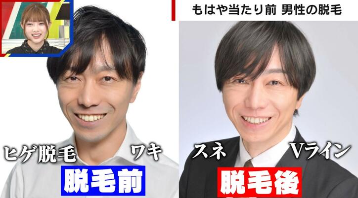 【写真・画像】男性の脱毛は「BTSの出現」が影響 全身ツルツルの慶大教授が「脱毛する自由と市民権」を指摘