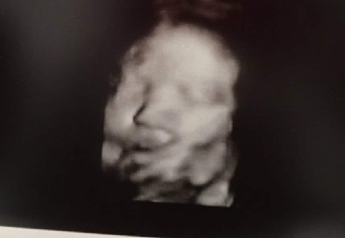 ゴマキの息子 すでにイケメンの兆し エコー写真に 鼻高い の声 話題 Abema Times