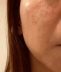 ココリコ遠藤嫁『みんなに心配された事』