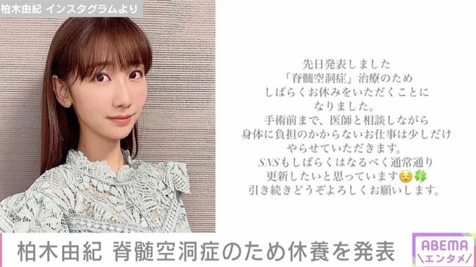 専門医「どの病院でも行える手術ではない」 柏木由紀が発表した「脊髄空洞症」とは 1枚目