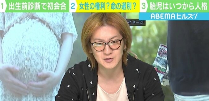 新型出生前診断は「命の選別」か？ 若新雄純氏が考える「決断の権利」と「意見の表明」 3枚目
