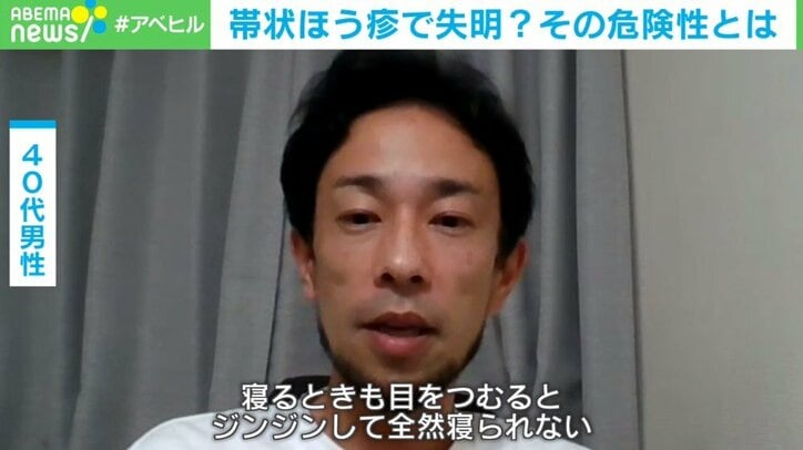 帯状疱疹で失明？ 疲れとストレスがトリガーに