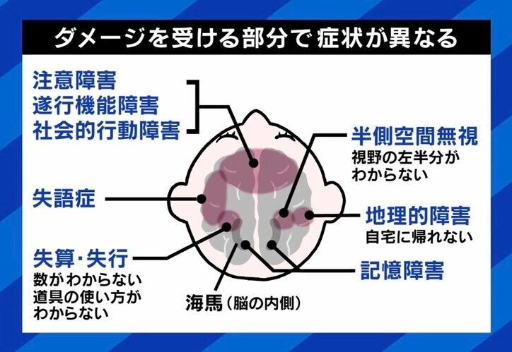 ダメージを受ける部分で症状が異なる