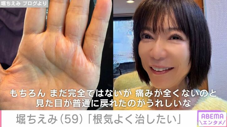 堀ちえみの手