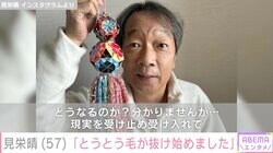 ステージ4の下咽頭がん公表の見栄晴、放射線治療の副作用を告白「とうとう毛が抜け始めました」