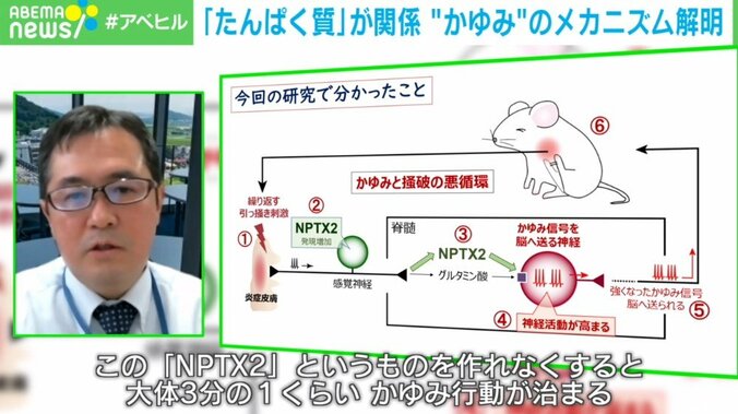 何度かいても治らない…“かゆみの悪循環”から抜け出すには? 教授が仕組みを解説 3枚目