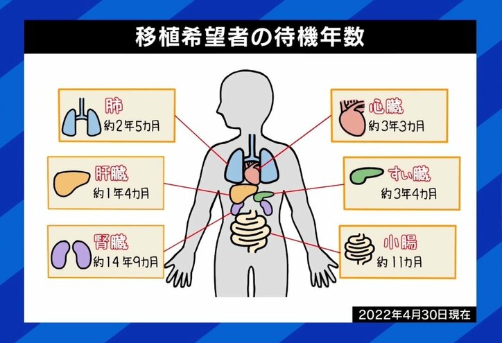 “臓器ドナー”不足が深刻化…提供者を増やすには? 夏野剛氏「経済的インセンティブを考える時期では」