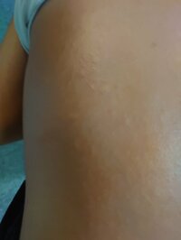 山田花子『長男のじんましん』