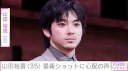 山田裕貴（35）、「緊急事態」最新ショットに心配の声「めっちゃ痛そう」「無理だけはなさらないで」