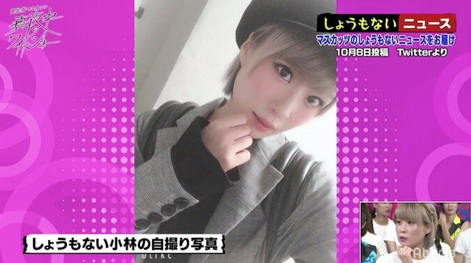 光浦靖子、「お金を持つとすぐ顔をイジる癖があるから！」 2枚目