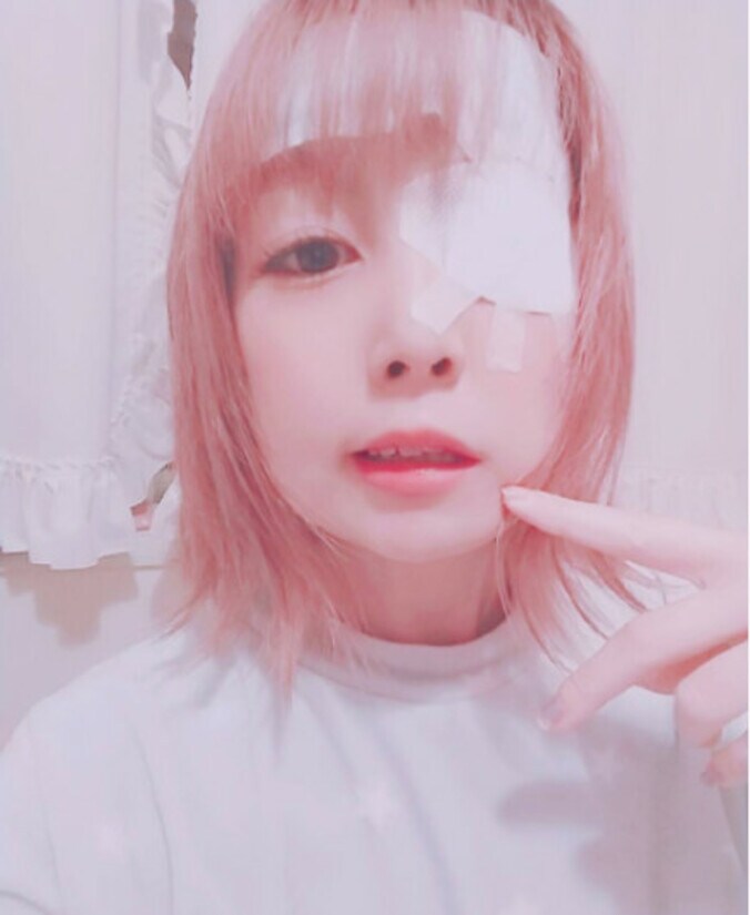 声優・姫野つばさ、  “左の唇がおかしい”と119番 ラムゼイ・ハント症候群で「顔面の麻痺しています」  1枚目