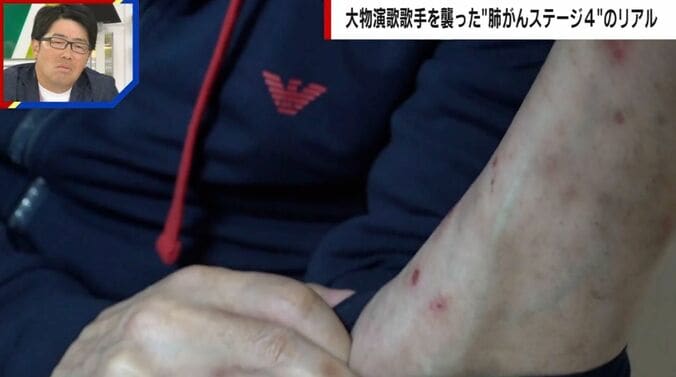 副作用に苦しむ山川豊