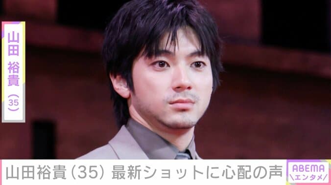 【写真・画像】山田裕貴（35）、「緊急事態」最新ショットに心配の声「めっちゃ痛そう」「無理だけはなさらないで」　1枚目