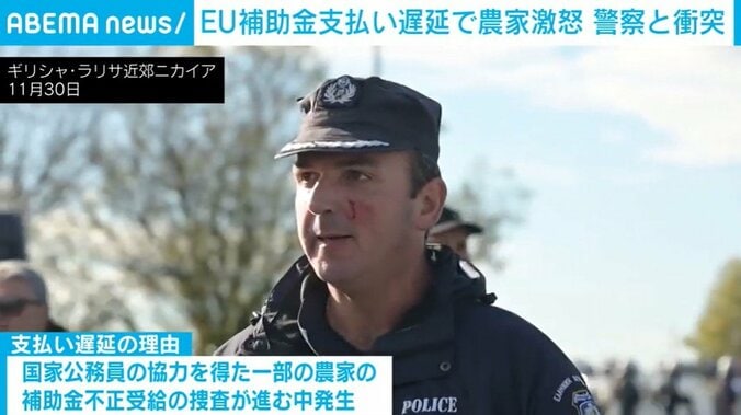 顔から血を流す警察