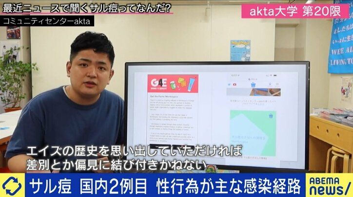 日本でも感染確認の「サル痘」、男性同性愛者への差別や偏見を生じさせない注意喚起を