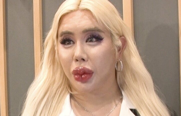 【写真・画像】アレン様、学生時代に受けた壮絶いじめを告白「本当の自分を押し殺して…」　1枚目