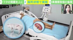 ブタからヒトへ“腎臓移植”米チームが成功 脳死状態で実施も…生命倫理に問題は？
