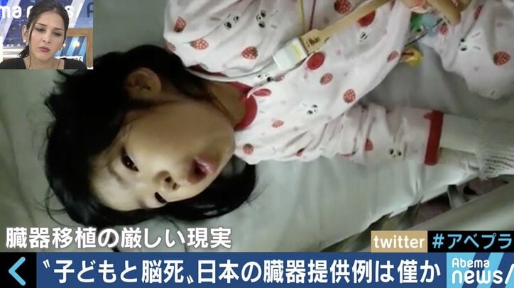今も１万人以上が「待機中」、失われた命も…世界に遅れを取る日本の臓器移植