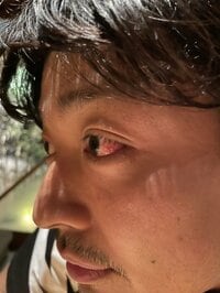 中村昌也『目が…』