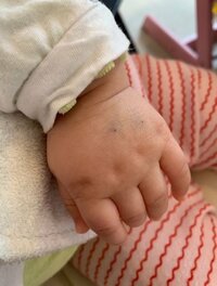 東尾理子、次女が肝臓機能の低下で脱水症状を起こし点滴「お大事に」「心配」の声