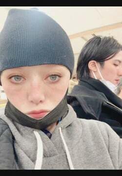  広田レオナ、股関節が壊死して手術の覚悟を決めるもインフルエンザに感染「何でこんな重症に」 