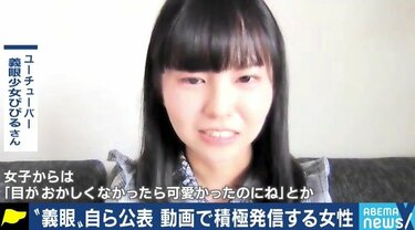 義眼で人生が変わった」「片目が見えるじゃないかと言われ、障害者として認めてもらえない」…当事者たちに聞いた「片目失明」のリアル | 国内 |  ABEMA TIMES | アベマタイムズ