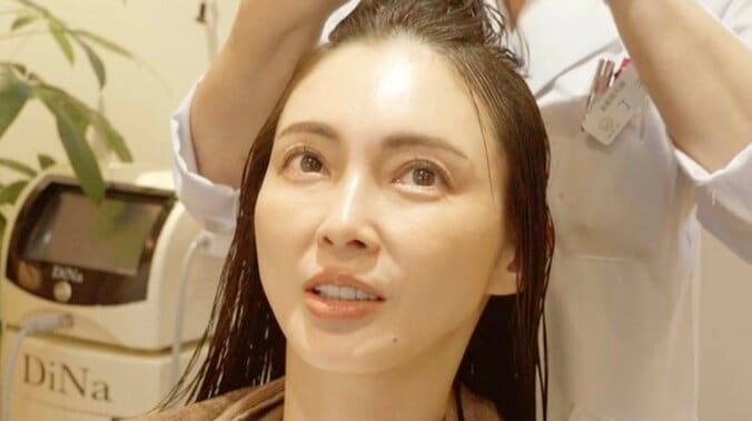 【写真・画像】「ピーリングしたら撮影日に顔の皮が…」 押切もえ（46）が失敗した美容語る　1枚目