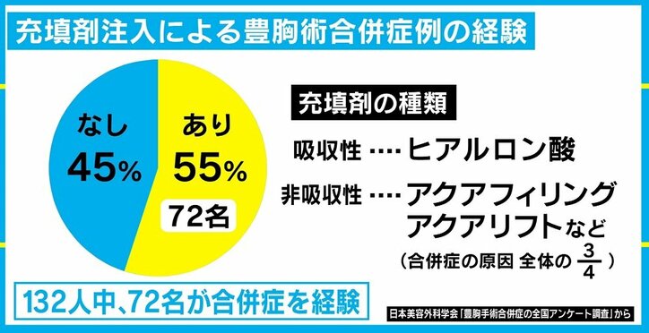 豊胸手術でしこりなどの“合併症”相次ぐ、ジェル状の充填剤に注意喚起