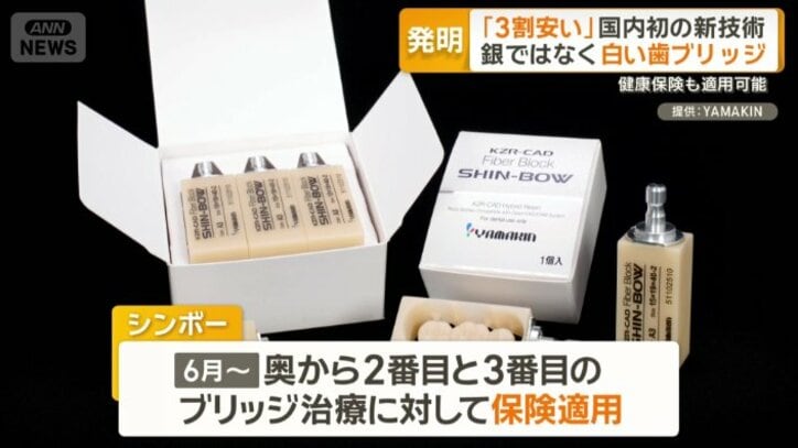 保険適用の銀歯のブリッジより安い