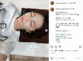 「針に刺されても美人」安田美沙子、鍼治療中のプライベートショットを公開「気持ち良さそう」「素敵です」と反響