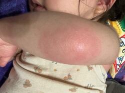  ANZEN漫才・あらぽんの妻、心配になり病院を受診するも原因不明だった娘の症状「夜にだんだんひどくなり」 