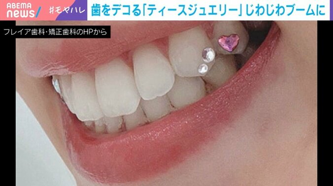 ティースジュエリー