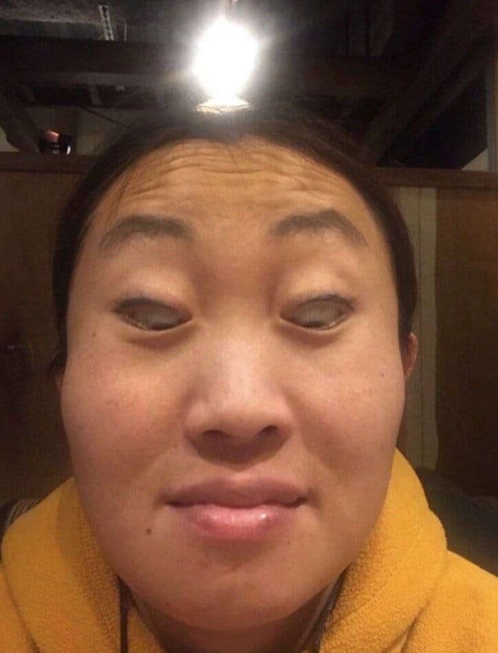 キンタロー。小学校の卒アル秘話を明かす「長いものにまかれるしかない時もある」