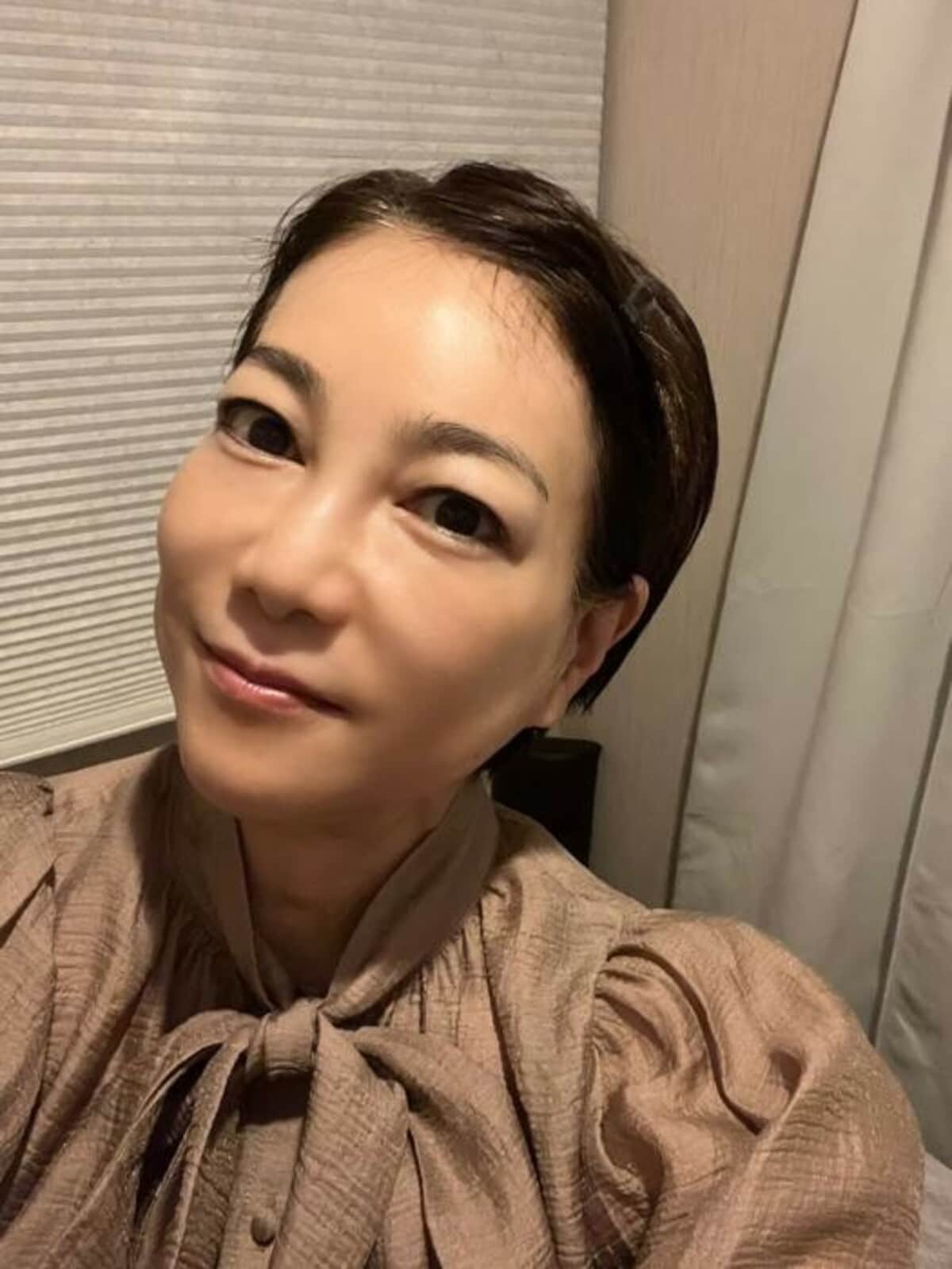 堀 ちえみ 整形