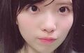 「中1で初整形」元国民的アイドル（24）、ダウンタイム中の顔写真を公開「鼻をフルでやってて。ここにプロテーゼ入ってて…」