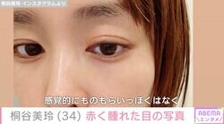 桐谷美玲、赤く腫れた目の写真を公開「何かしらの不調が続く4月」