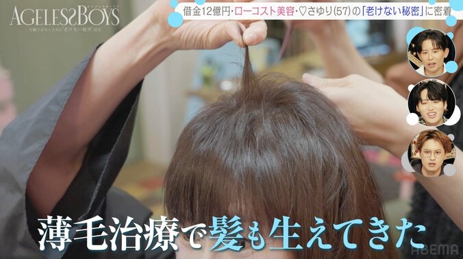 【写真・画像】“ミスコン荒らし“57歳女性芸人、2時間睡眠生活で「お札ぐらいの円形脱毛症ができた」 薄毛治療も　2枚目
