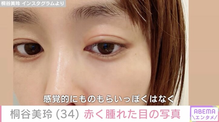 【写真・画像】桐谷美玲、赤く腫れた目の写真公開「何かしらの不調が続く4月」　1枚目