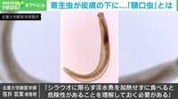 【映像】寄生虫が皮膚の下に...「顎口虫」とは