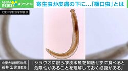 皮膚の下に現れた“顎口虫”…シラウオを食べた患者から検出 専門家が警鐘