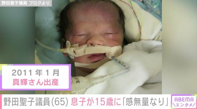 50歳で出産・野田聖子議員（65）、生後2年以上入院した息子が15歳に「やっと150センチ超え、やっと40キロ超え、やっとかけ算の入り口」 2枚目