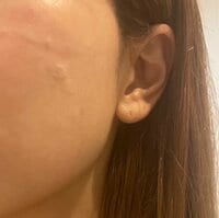 ココリコ遠藤嫁『コンプレックス』