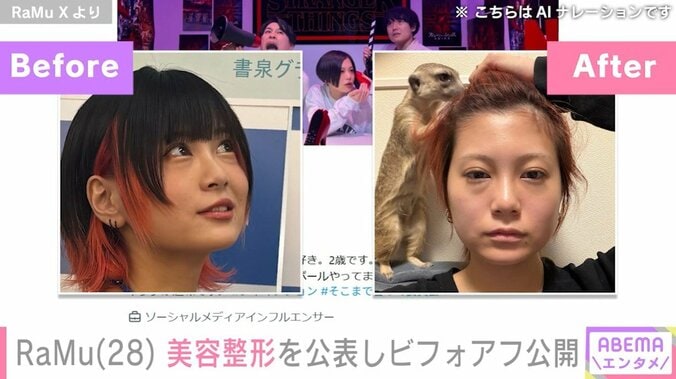 RaMu、整形のビフォーアフター