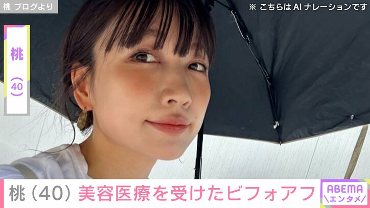 【写真・画像】“3度の二重整形”桃(40) ほうれい線対策の最新美容医療を受けたビフォーアフターを公開　1枚目