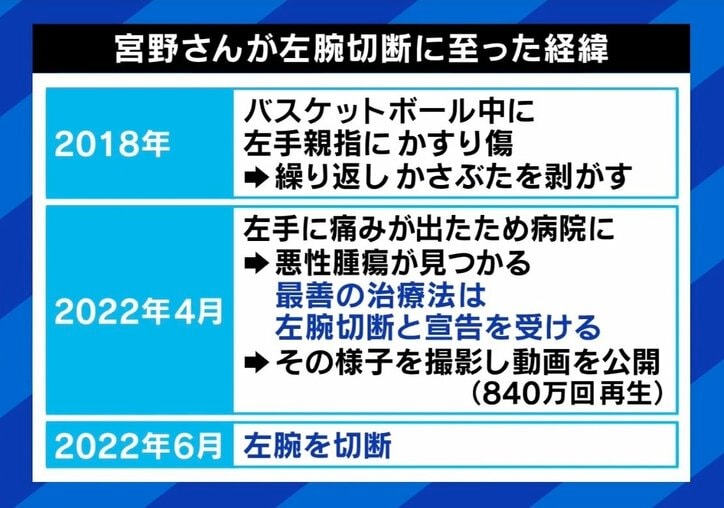「いじっていいよ」障害者＝笑えない？ 芸人の夢をあきらめ…“かすり傷”きっかけで片腕を失った男性に反響