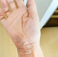 AHN MIKA『術後の経過報告！お陰様で。。。』