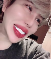 アレン『見事、歯抜け人生…から脱出ょ‼️✨❤️』