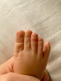 紺野あさ美『赤ちゃんの指に髪の毛が絡まる④ -対策-』