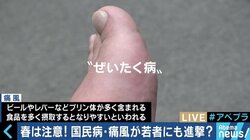 若者・女性の患者も増加！国民病“痛風”を予防するには？